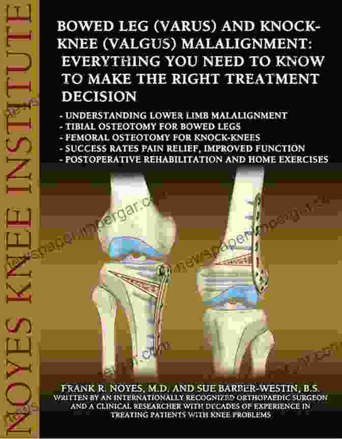 Book Cover For Everything You Need To Know To Make The Right Treatment Decision The Unstable Patella (Kneecap): Everything You Need To Know To Make The Right Treatment Decision